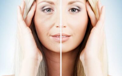 Looking & Feeling Younger: What To do to Fight Signs of Aging