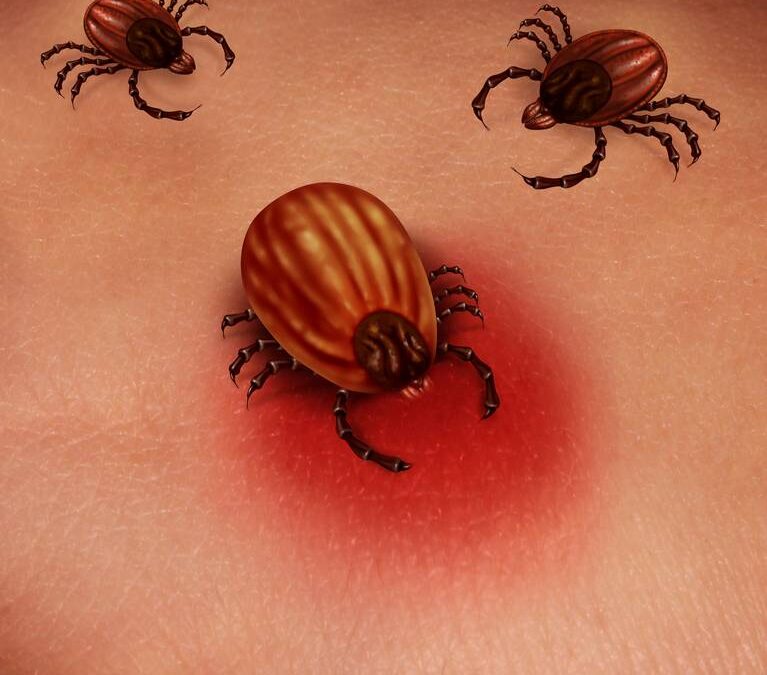 Lyme Disease Myths: Tops Facts About the Tick-Borne Disease