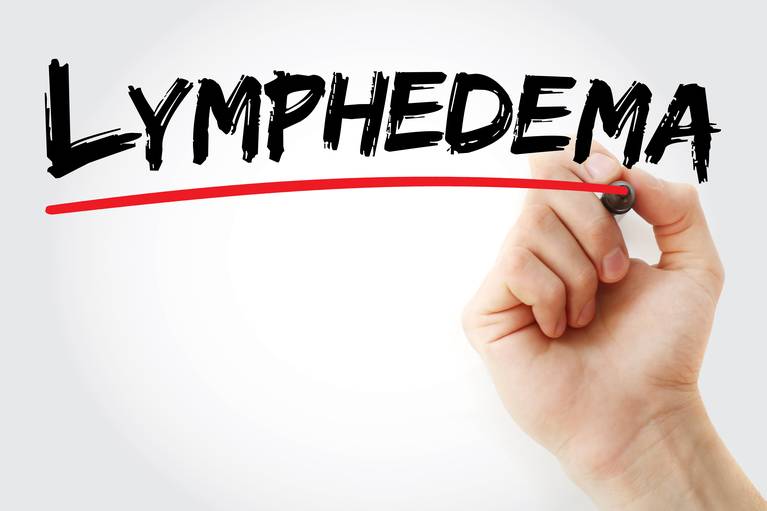 What is Lymphedema and How Is It Treated?